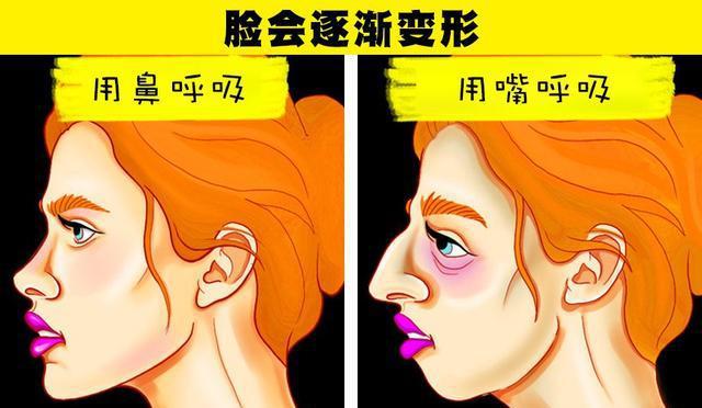 下巴前突要怎么改善_有什么办法可以把下巴前突正过来_下巴前突会越来越严重吗