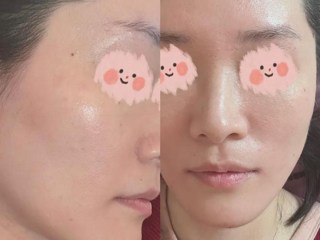 弹簧断接上可以修复吗_弹簧断了怎么可以接上_弹簧断接上可以焊接吗