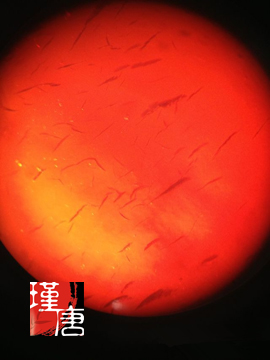 放大镜能看清螨虫吗_100倍放大镜能看什么_放大镜能看到螨虫吗
